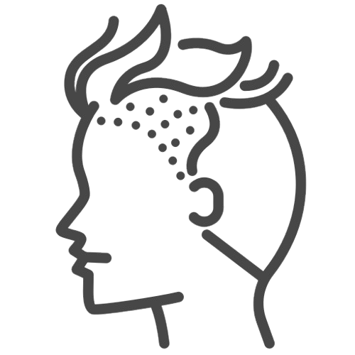 Male_Hair_Loss_icon-removebg-preview